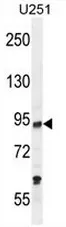 KAT2B (C-term) Rabbit Polyclonal Antibody - image 1