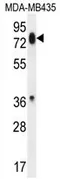 Protocadherin beta 13 (PCDHB13) (Center) Rabbit Polyclonal Antibody - image 1