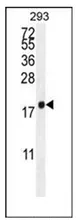 PCOTH (Center) Rabbit Polyclonal Antibody - image 1