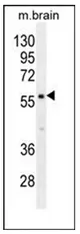 PDE1B (C-term) Rabbit Polyclonal Antibody - image 1