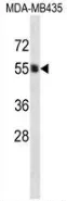 PIGA (C-term) Rabbit Polyclonal Antibody - image 1