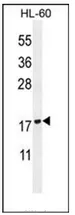 PLA2G2D (C-term) Rabbit Polyclonal Antibody - image 1