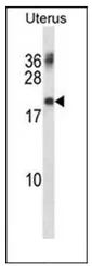 PMP22 Rabbit Polyclonal Antibody - image 1