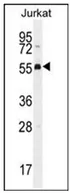 PODNL1 (Center) Rabbit Polyclonal Antibody - image 1