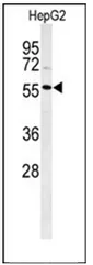 DNA Polymerase lambda (POLL) (C-term) Rabbit Polyclonal Antibody - image 1