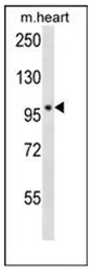 POLN (C-term) Rabbit Polyclonal Antibody - image 1