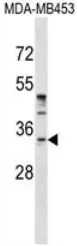 POU6F1 (N-term) Rabbit Polyclonal Antibody - image 1