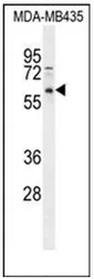 PPP3CC (N-term) Rabbit Polyclonal Antibody - image 1