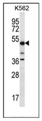 PSTPIP1 (N-term) Rabbit Polyclonal Antibody - image 1