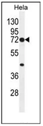 COX2 (PTGS2) (Center) Rabbit Polyclonal Antibody - image 1