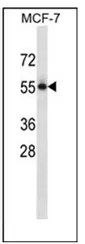 Nectin 3 (NECTIN3) (C-term) Rabbit Polyclonal Antibody - image 1