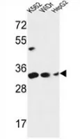 PYCR1 (C-term) Rabbit Polyclonal Antibody - image 1