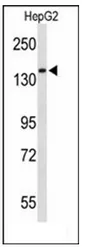RECK (Center) Rabbit Polyclonal Antibody - image 1