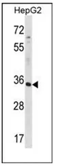 RFNG (C-term) Rabbit Polyclonal Antibody - image 1