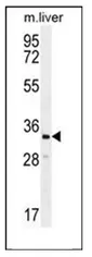 CLVS2 (C-term) Rabbit Polyclonal Antibody - image 1