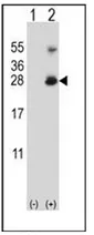 RNF11 (Center) Rabbit Polyclonal Antibody - image 1