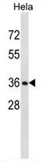 RNF34 (C-term) Rabbit Polyclonal Antibody - image 1