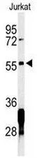 RNF8 Rabbit Polyclonal Antibody - image 1