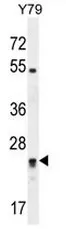 DPCD (Center) Rabbit Polyclonal Antibody - image 1