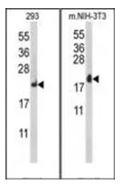 RPL18A (C-term) Rabbit Polyclonal Antibody - image 1