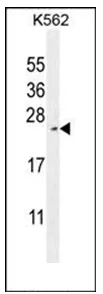 RTP4 (C-term) Rabbit Polyclonal Antibody - image 1