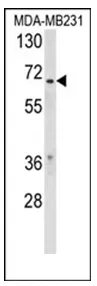 Retinoid X Receptor beta (RXRB) (Center) Rabbit Polyclonal Antibody - image 1