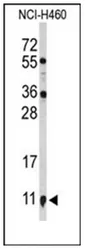 S100A10 (Center) Rabbit Polyclonal Antibody - image 1