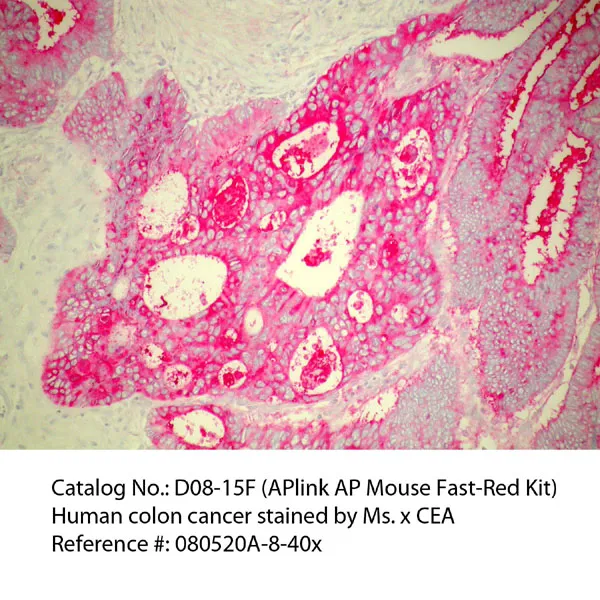 APlink AP Mouse Permanent Red Detection Kit - image 1