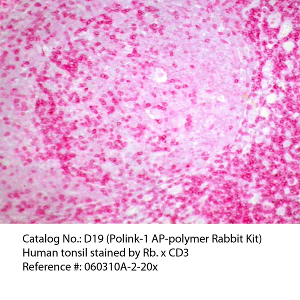 Polink-1 AP Rabbit Permanent Red Detection Kit - image 1