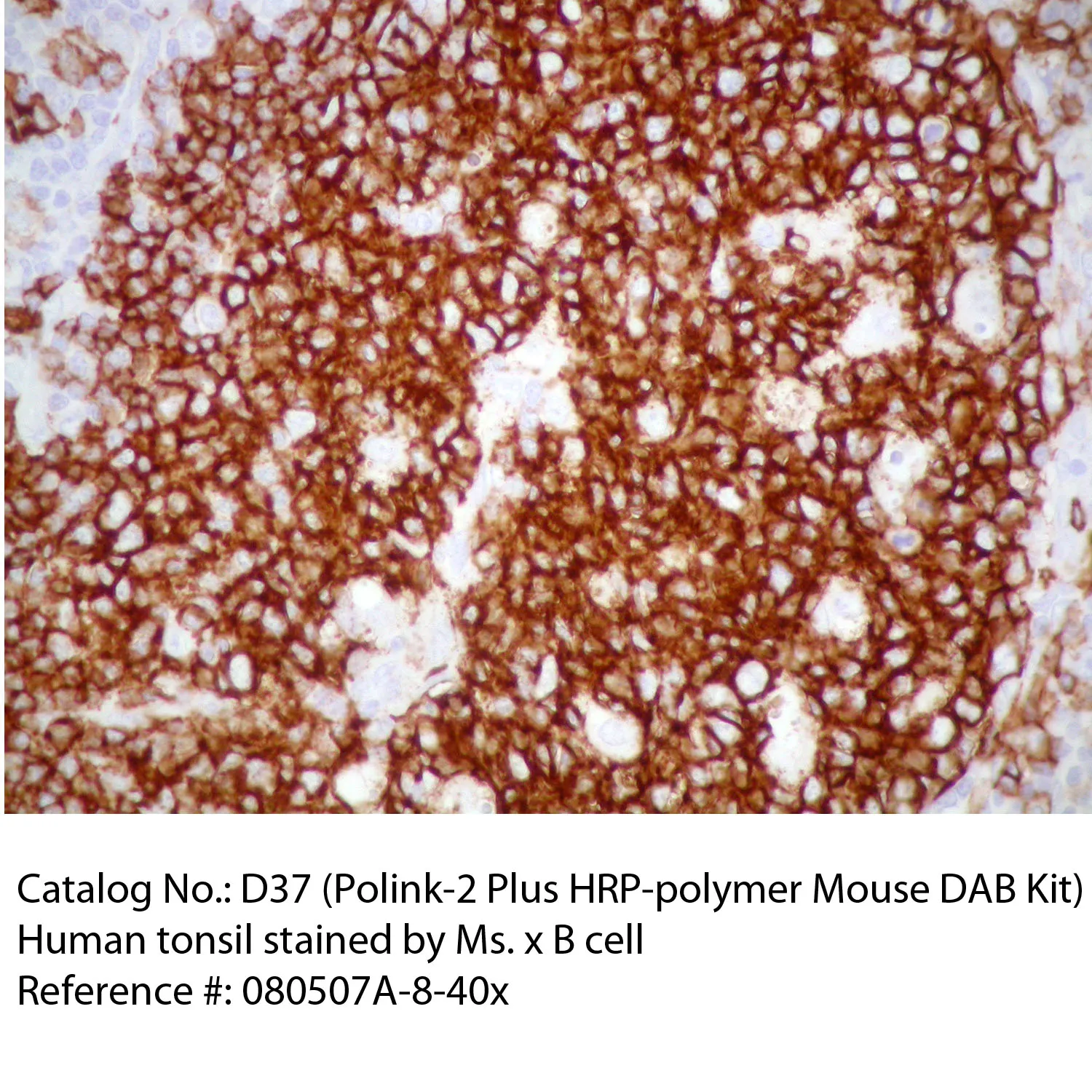 Polink-2 Plus HRP Mouse DAB Detection Kit - image 1
