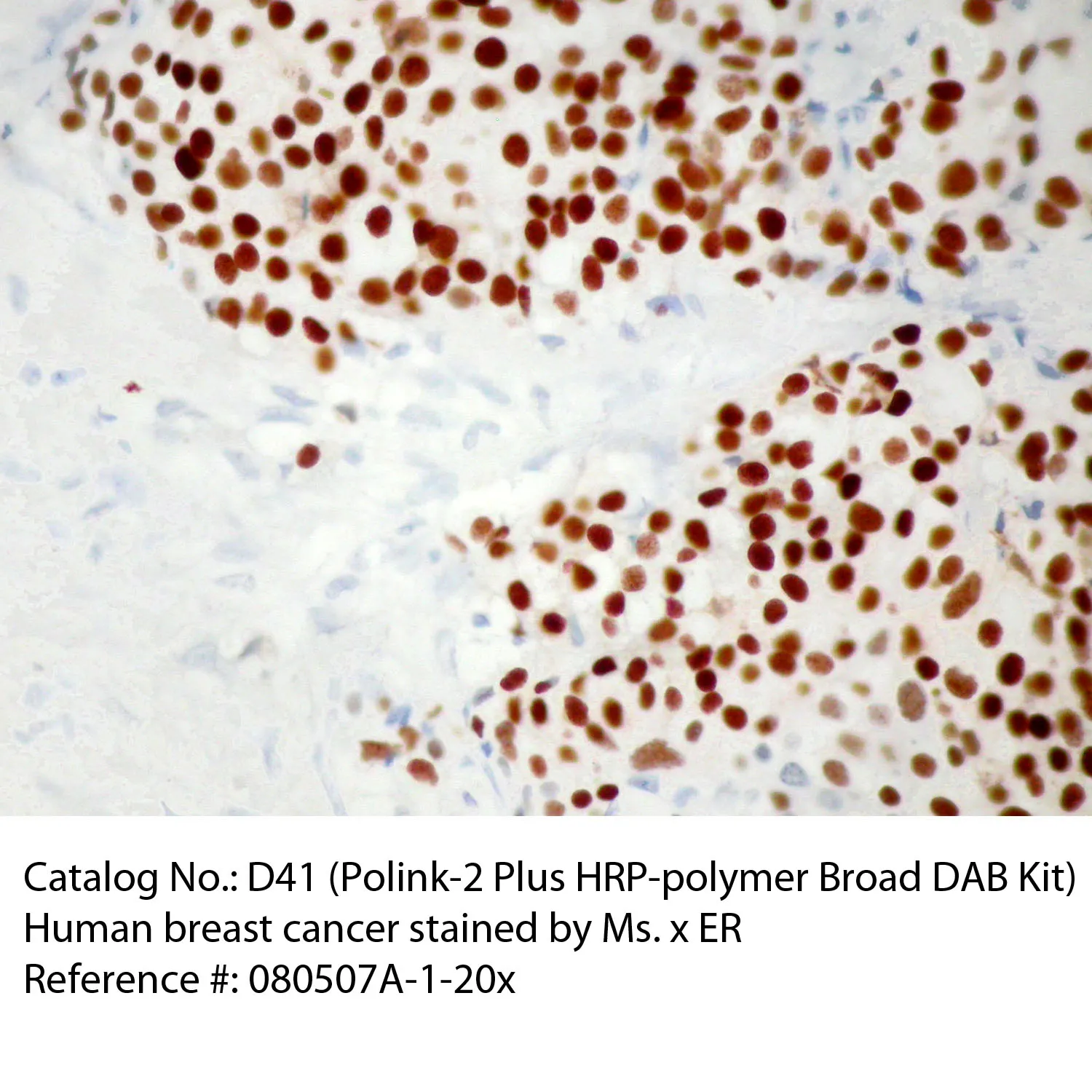Polink-2 Plus HRP Broad Spectrum DAB Detection Kit - image 1