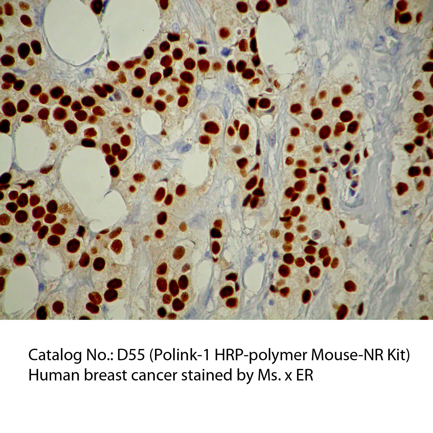 Polink-1 HRP Mouse-NR DAB Detection Kit - image 1