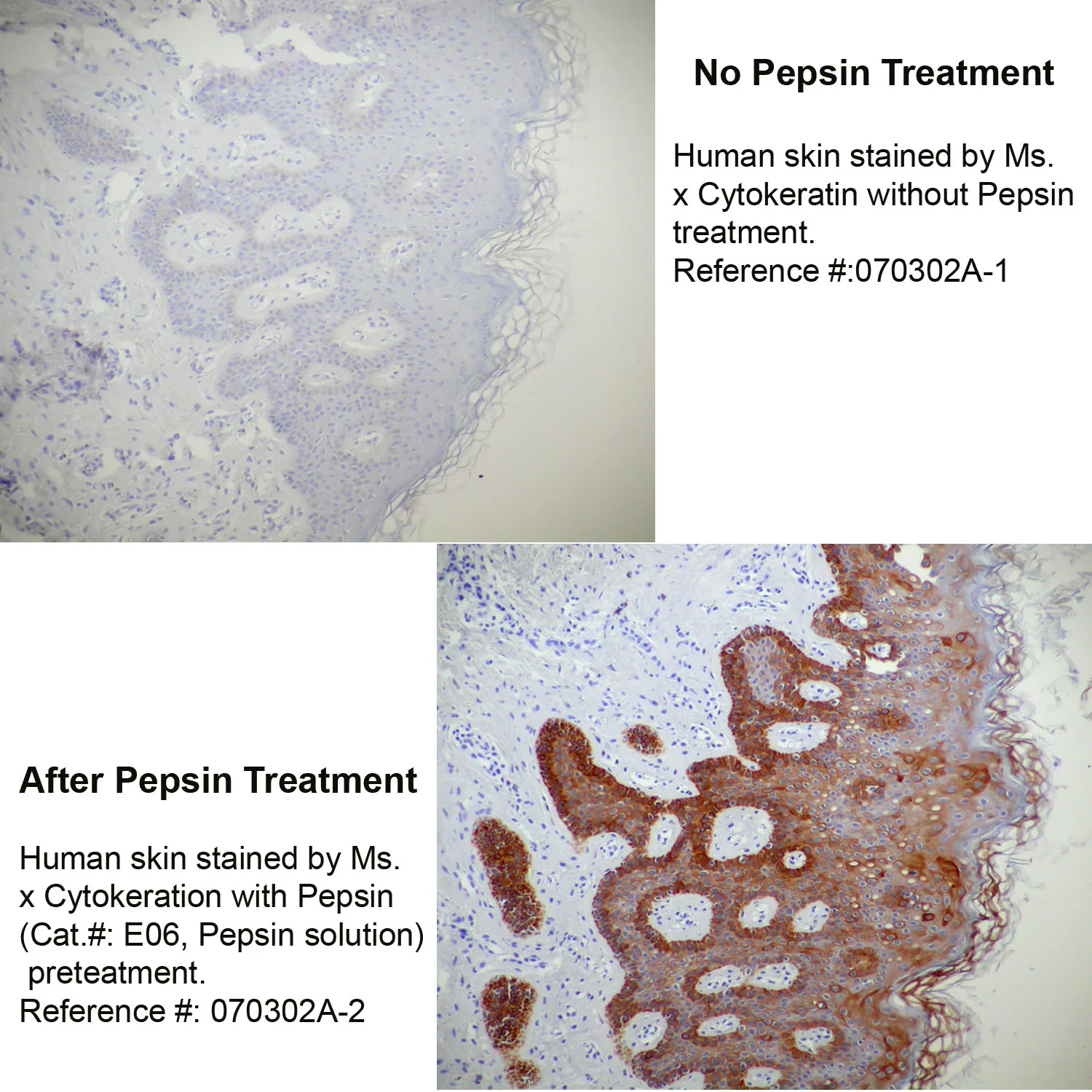Pepsin Solution - image 1