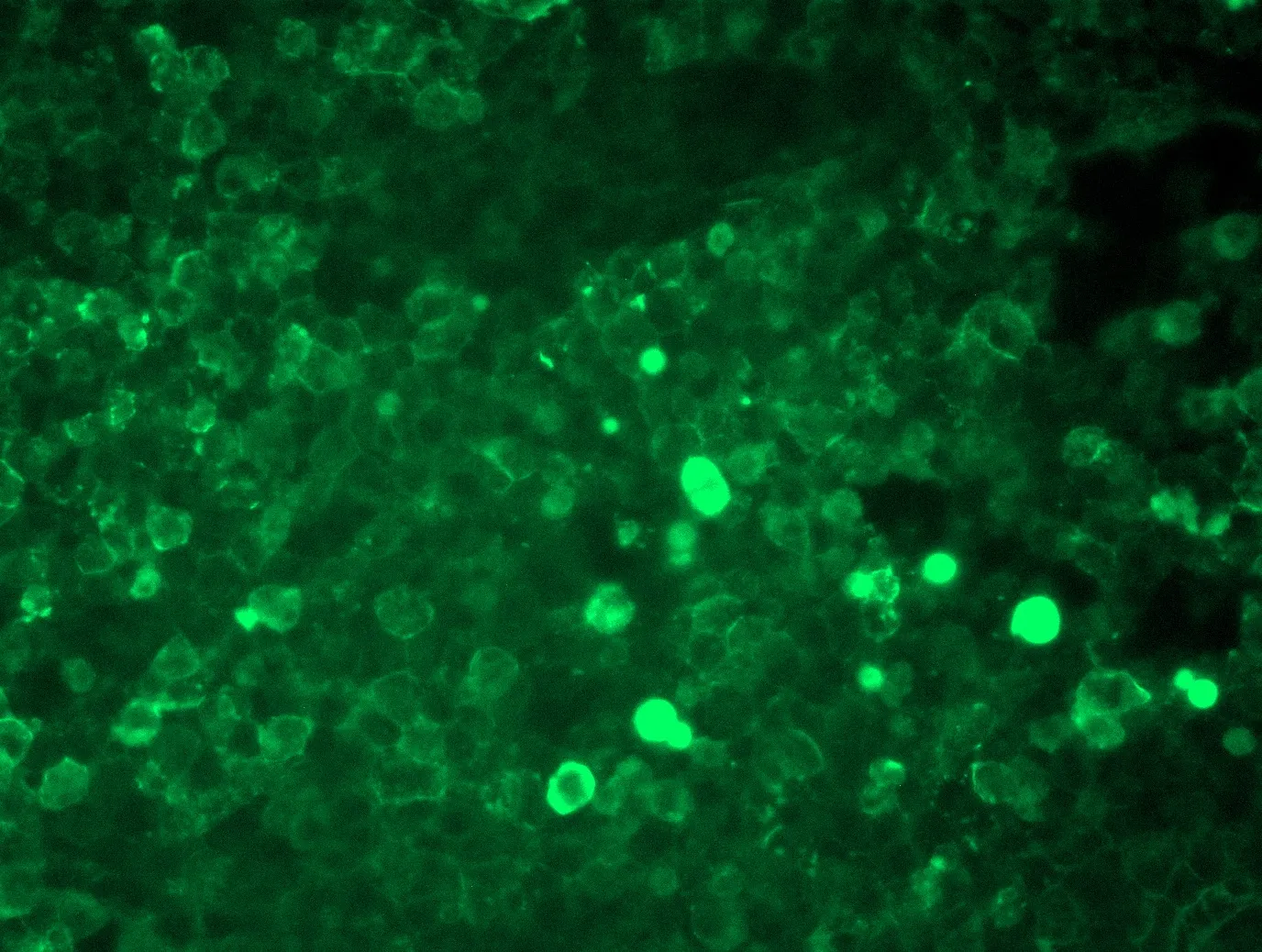 Human CD36 (NM_001001548) AAV Particle - image 1