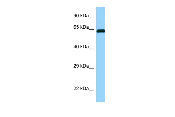 SSH3BP1 (ABI1) Rabbit Polyclonal Antibody - image 1