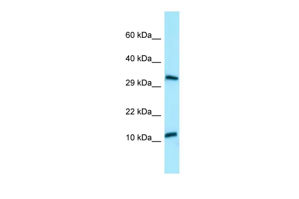BPY2 Rabbit Polyclonal Antibody - image 1