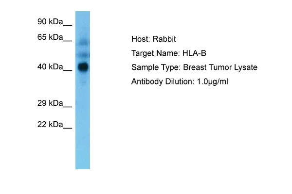 HLAB (HLA-B) Rabbit Polyclonal Antibody - image 1