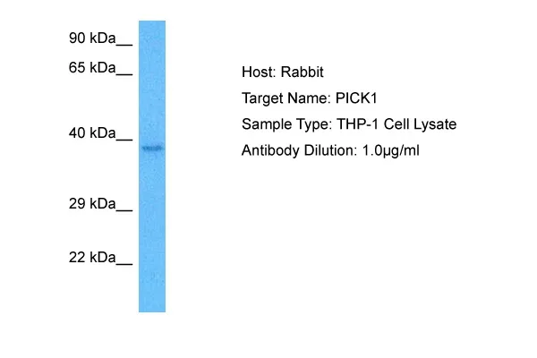 PICK1 Rabbit Polyclonal Antibody - image 1