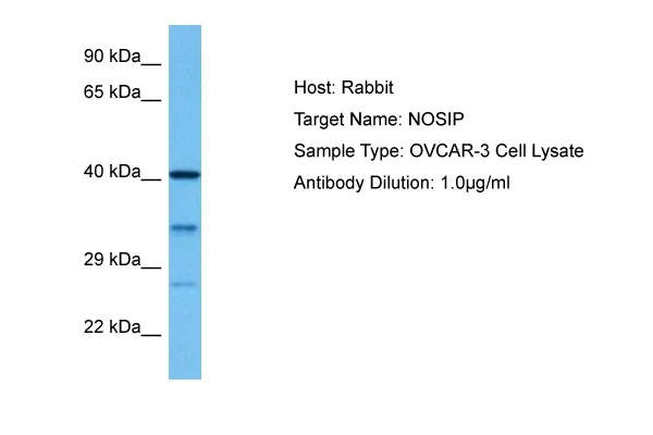 NOSIP Rabbit Polyclonal Antibody - image 1