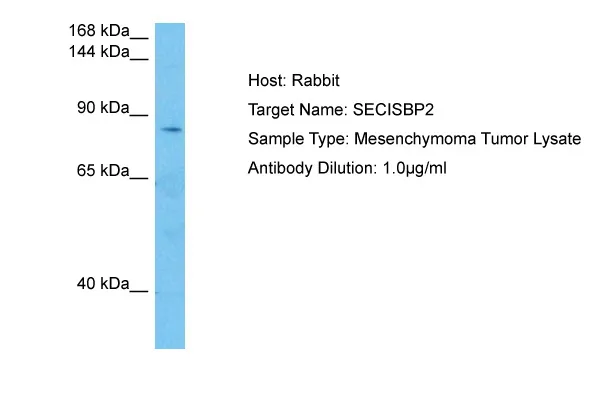SECISBP2 Rabbit Polyclonal Antibody - image 1