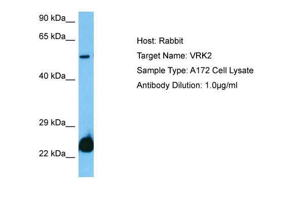 VRK2 Rabbit Polyclonal Antibody - image 1