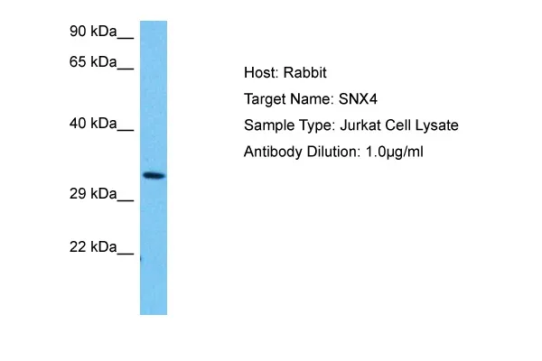 SNX4 Rabbit Polyclonal Antibody - image 1