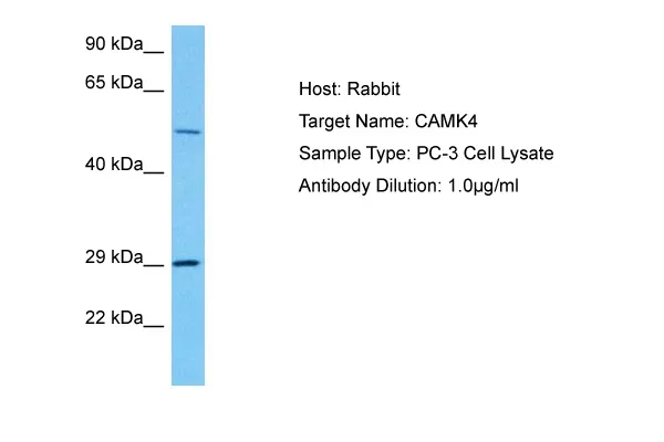 CAMKIV (CAMK4) Rabbit Polyclonal Antibody - image 1