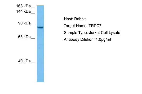 TRP 7 (TRPC7) Rabbit Polyclonal Antibody - image 1