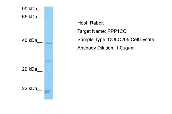 PP1C gamma (PPP1CC) Rabbit Polyclonal Antibody - image 1
