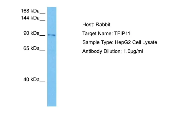 TFIP11 Rabbit Polyclonal Antibody - image 1