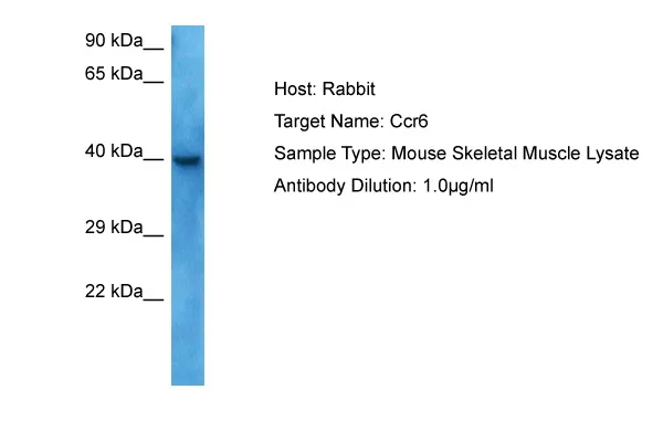 Ccr6 Rabbit Polyclonal Antibody - image 1