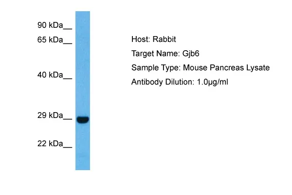 Gjb6 Rabbit Polyclonal Antibody - image 1