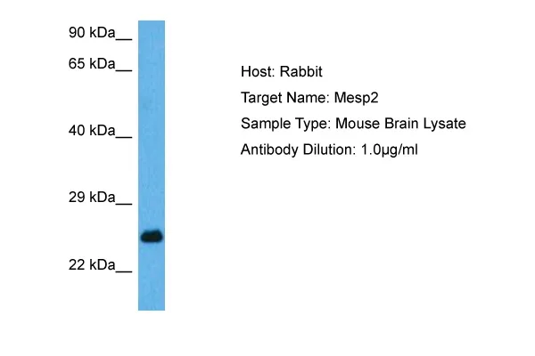 Mesp2 Rabbit Polyclonal Antibody - image 1