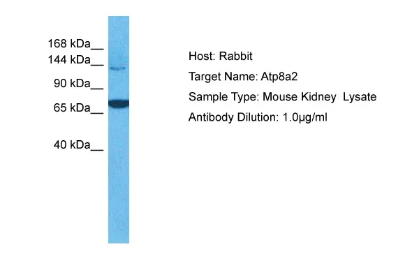 Atp8a2 Rabbit Polyclonal Antibody - image 1